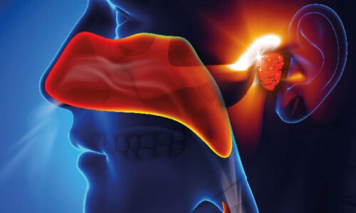 Otolaryngology