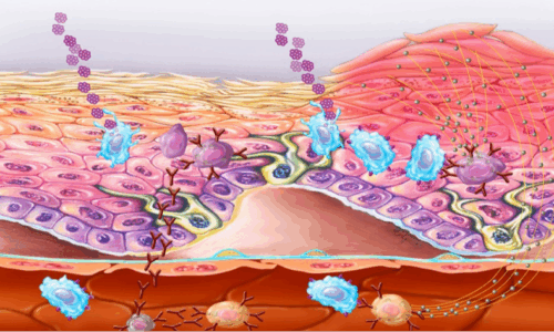 Dermatology