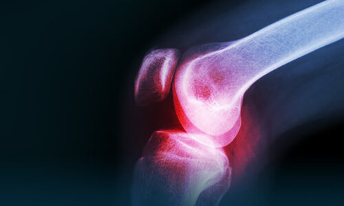 Physical Medicine Rheumatology and Rehabilitation
